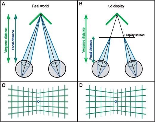 Here is an image demonstrating a vergence mismatch between eyes.